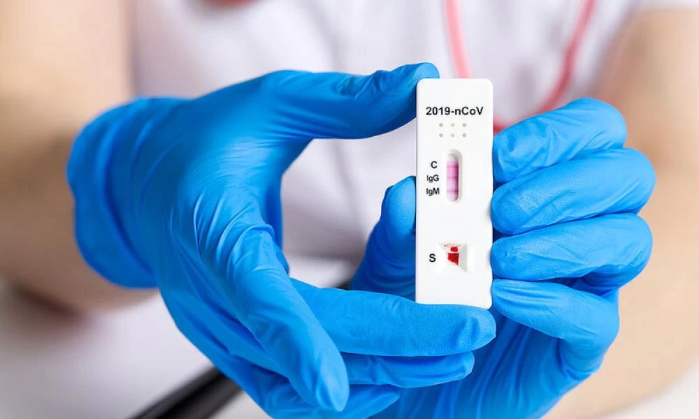 Rapid test: Διευκρινίσεις για την υποβολή στο ΕΡΓΑΝΗ